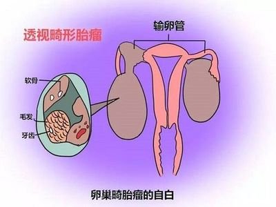 输卵管结扎复通术要注意什么？