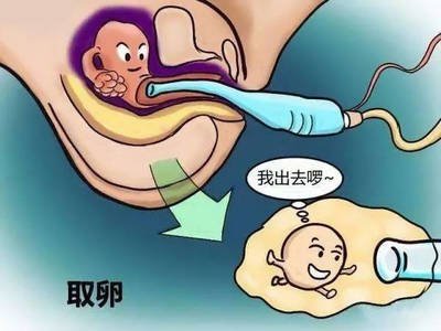 做试管婴儿前都需结扎输卵管吗