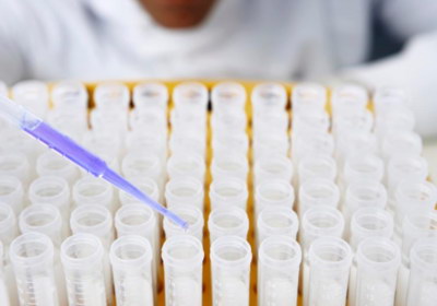 胚胎移植前，为什么有时候还需要做宫腔镜？