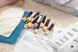 去英国冷生育力保存子费用曝光！说不到4万的都是机构套路