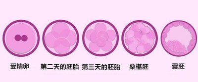 格鲁吉亚试管婴儿技术如何