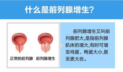 试管医治期间需要进行免疫检查吗
