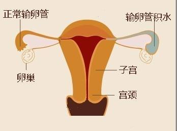 东莞试管婴儿哪家好