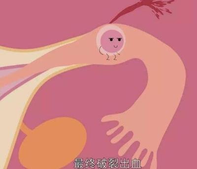 子宫有哪些具体作用久备不孕适合深圳试管婴儿助孕吗
