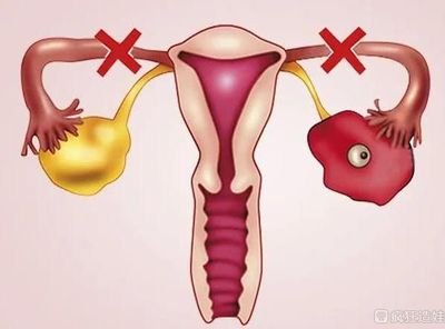 佛山单身女人可以做试管婴儿吗