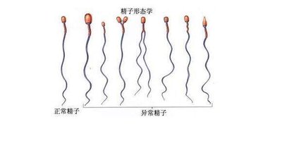 东莞试管婴儿价格