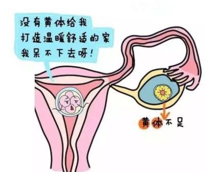 排卵障碍潮州试管婴儿怎么移植冷生育力