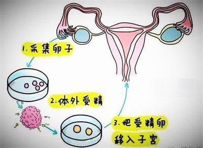 东莞单身未婚女性可以做试管婴儿吗