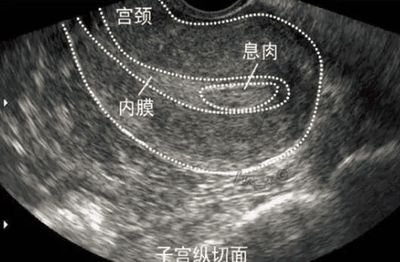 想要生双宝宝就可以直接去做惠州试管助孕吗