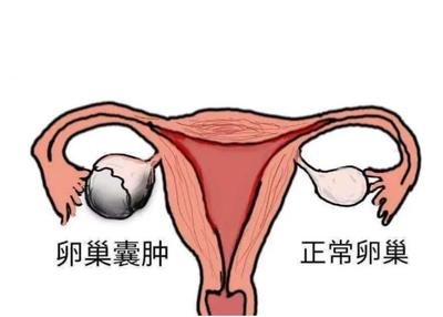 深圳试管婴儿技术在孕期有哪些特别的注意事项？怀孕各个阶段的饮食和生活习惯应该如何调整？