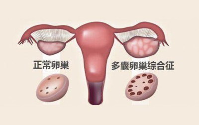 中山单身试管婴儿