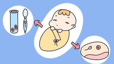 什么是少精子症能不能做惠州试管婴儿医治