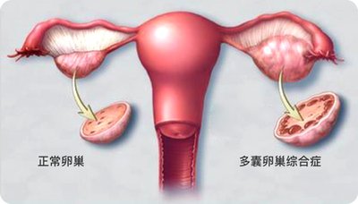 促排卵用药有哪些常见问题需要理解（二）