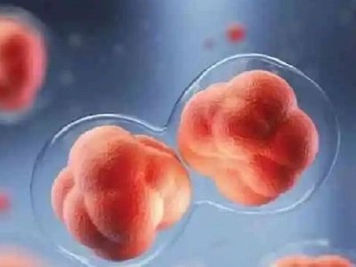 子宫内膜异位症患上后有哪些症状