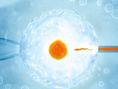 单角子宫自然怀孕难可以做试管婴儿吗