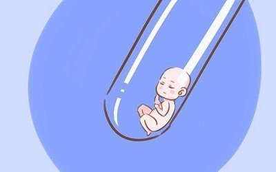 抗心磷脂抗体正常值标准是多少？抗心磷脂抗体怎么治疗？抗心磷脂抗体阳性对试管婴儿助孕有什么影响？