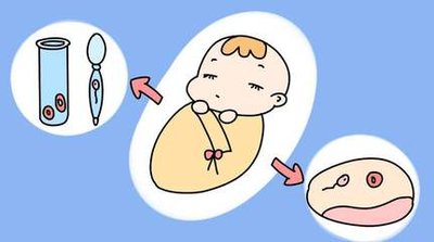 试管婴儿卵子质量不佳该怎么办,能成功怀孕吗