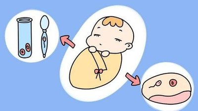 格鲁吉亚试管婴儿费用
