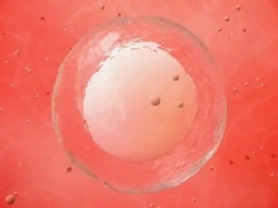 多囊卵巢综合征（PCOS）难孕可以选择试管婴儿助孕吗