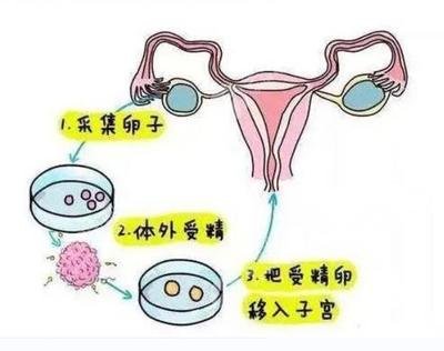 什么是弱精症能不能试管婴儿医治