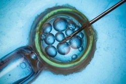 深圳单身女人可以做试管婴儿吗