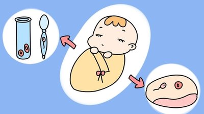 宫腔粘连是如何发生的能不能做试管婴儿医治