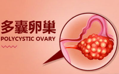 试管婴儿进周前男方的精子情况该如何判断