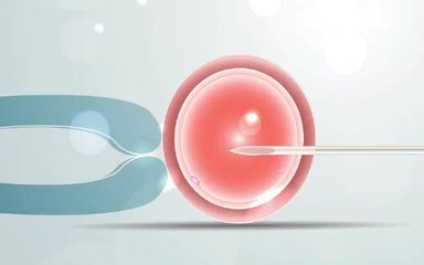 患上巧克力囊肿怀孕艰难可以选择试管婴儿助孕吗