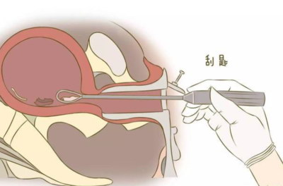 试管机构深圳