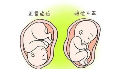 我的胚胎这么差，还有机会怀孕吗